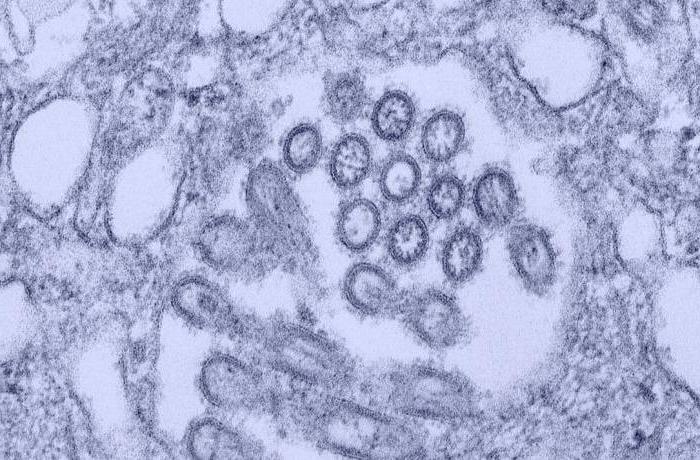 Microscopic View of Influenza